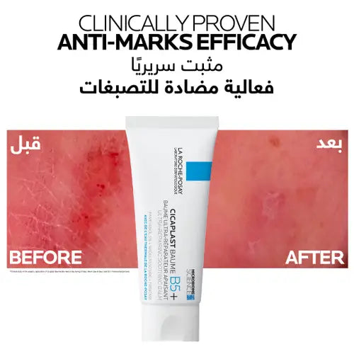 La Roche Posay Cicaplast Baume B5+ Ultra Repairing Soothing Balm 40ML